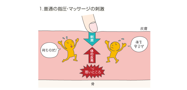 1.普通の指圧・マッサージの刺激の図。指圧などの刺激に対し体を守ろうとして、反発してしまいます。